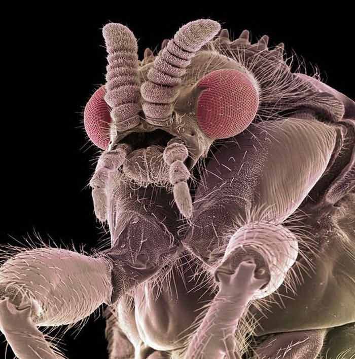 Насекомые под микроскопом - голова стрекозы